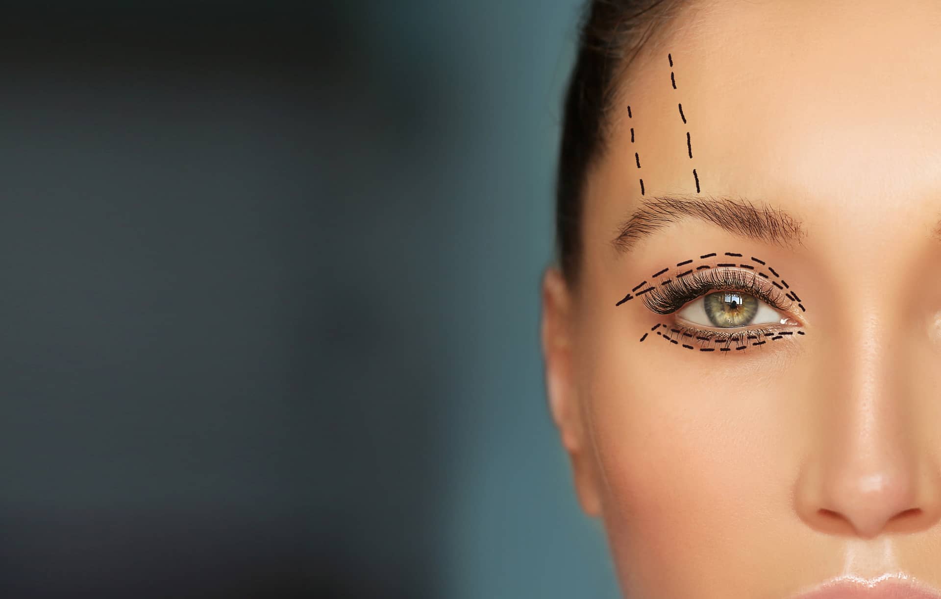 How To Fix Droopy Eyelids With Cosmetic Surgery Patient Overview