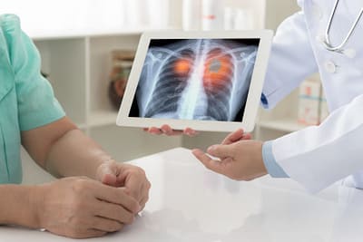 Doctor holding x-ray of lungs on tablet