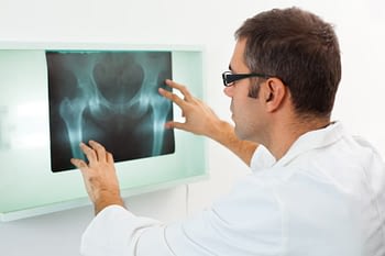 Doctor Examines X-Ray Of Hips