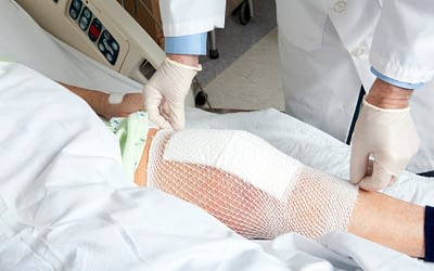 When to Consider a Total Knee Replacement or Knee Revision