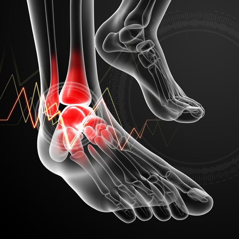 Ankle Arthroscopy High Mountain Orthopedics