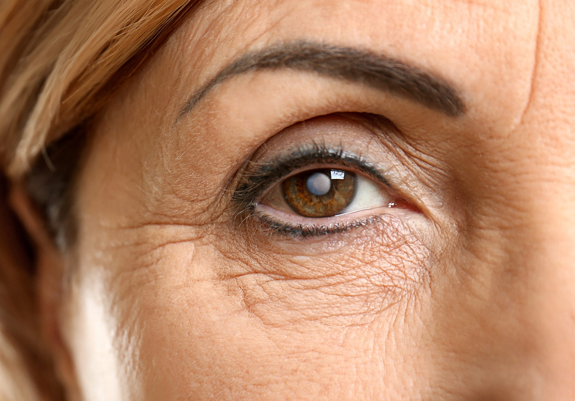 Cataract concept. Senior woman’s eye, closeup