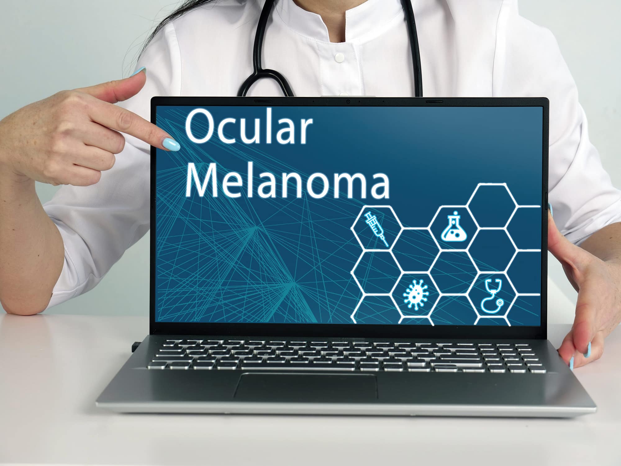 Ocular Melanoma phrase on the screen. Neurologist use cell tech