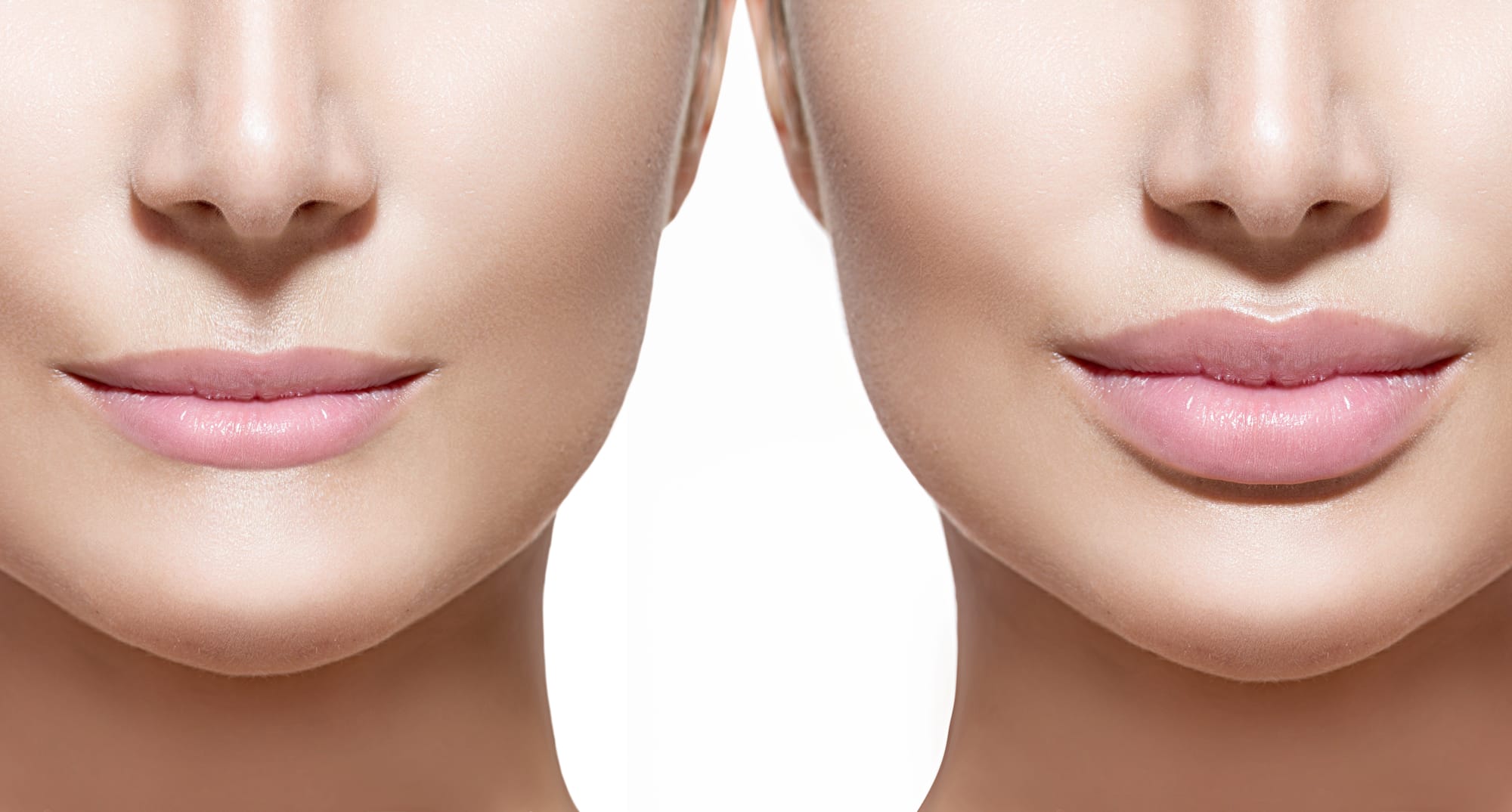 Juvederm Bayview Plastic Surgery in Houston, TX