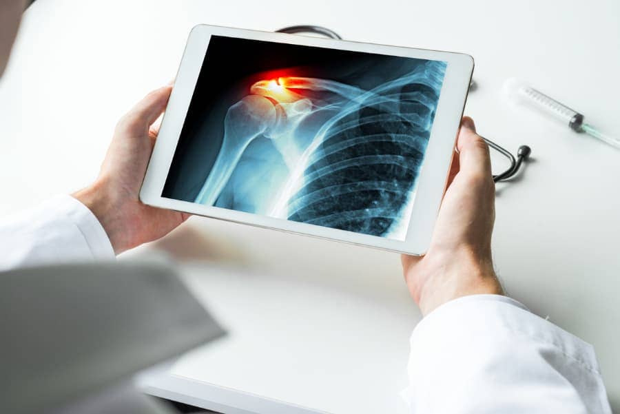 Shoulder X-Ray Tablet