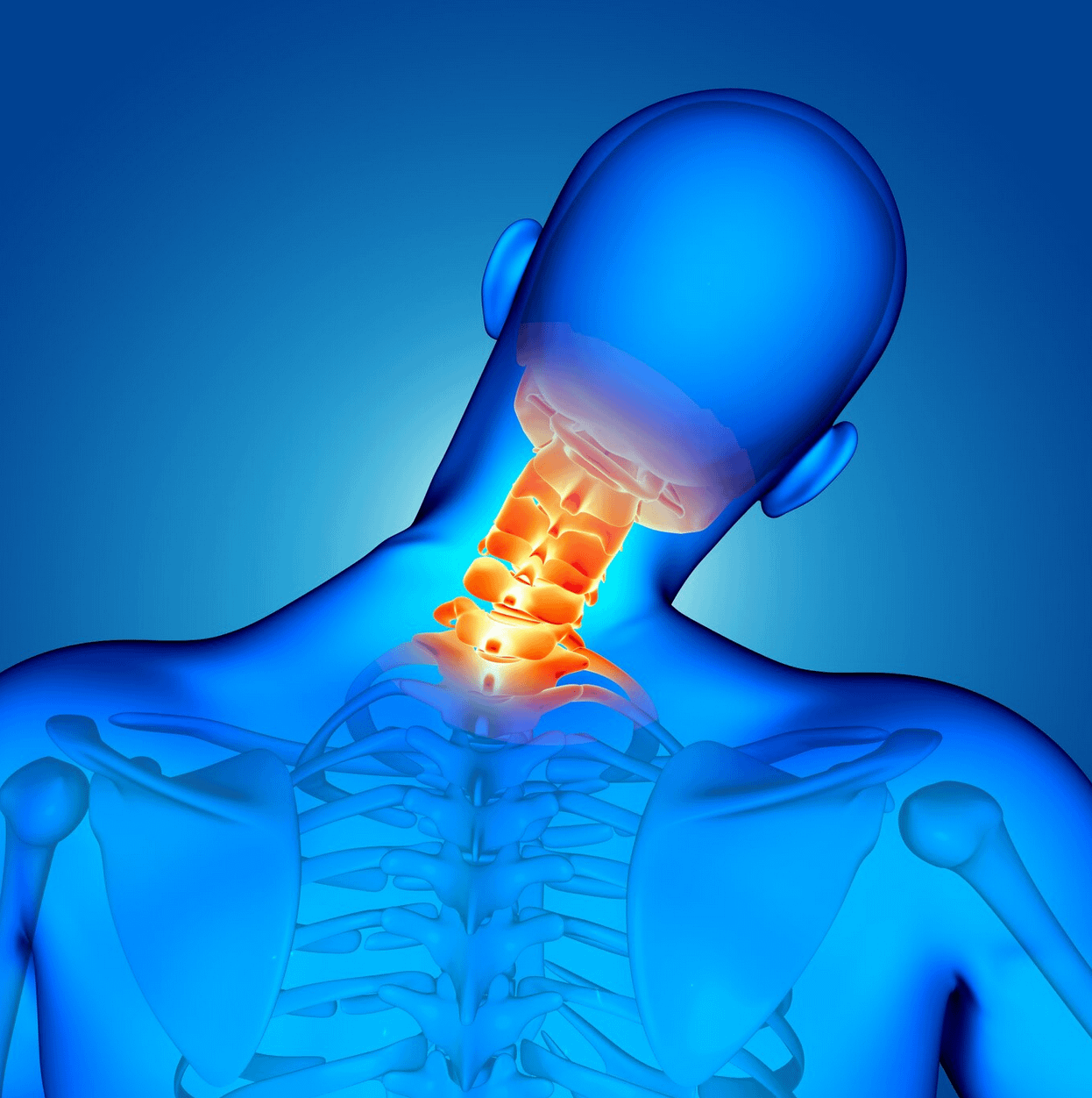 Anterior Cervical Decompression and Fusion 