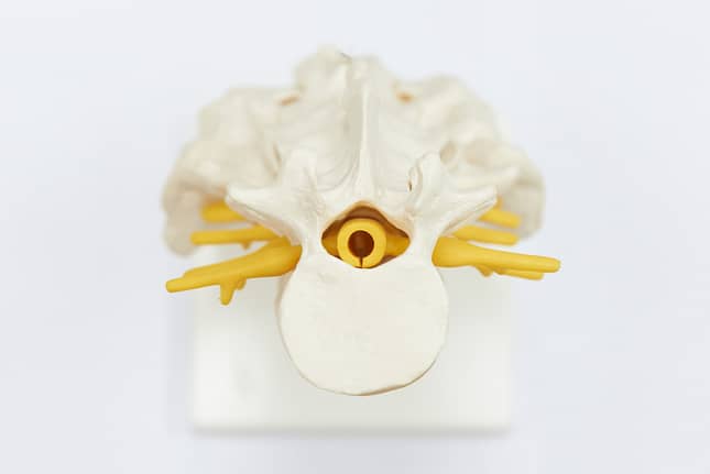 Spine Strengthening or Minimally Invasive Nerve Decompression