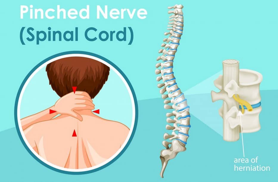 Spinal cord stimulator