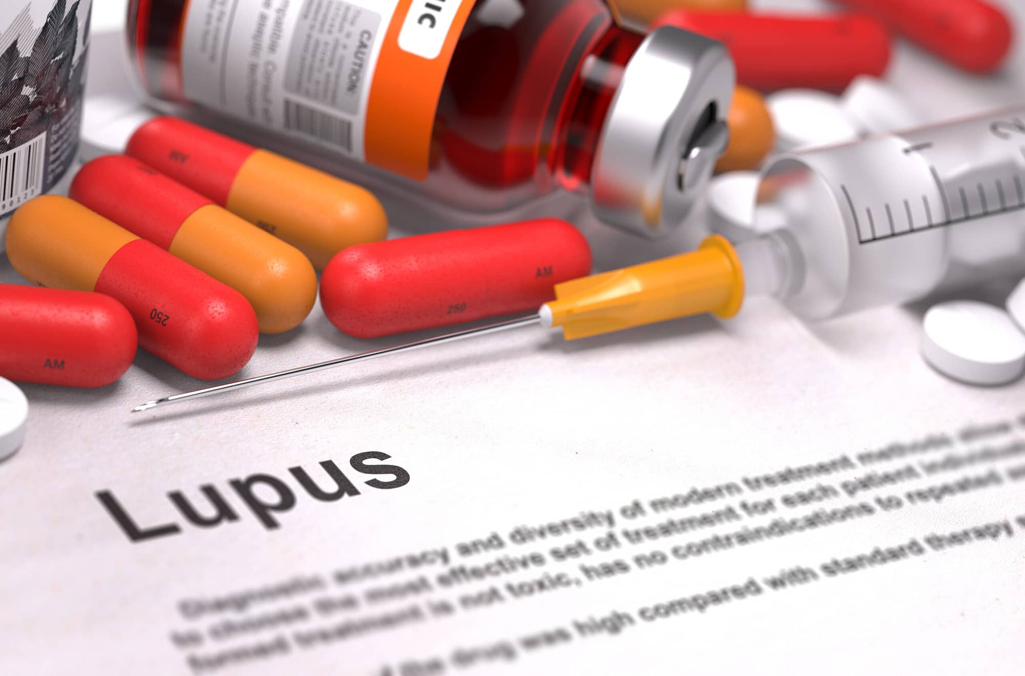 Diagnosis – Lupus. Medical Concept.