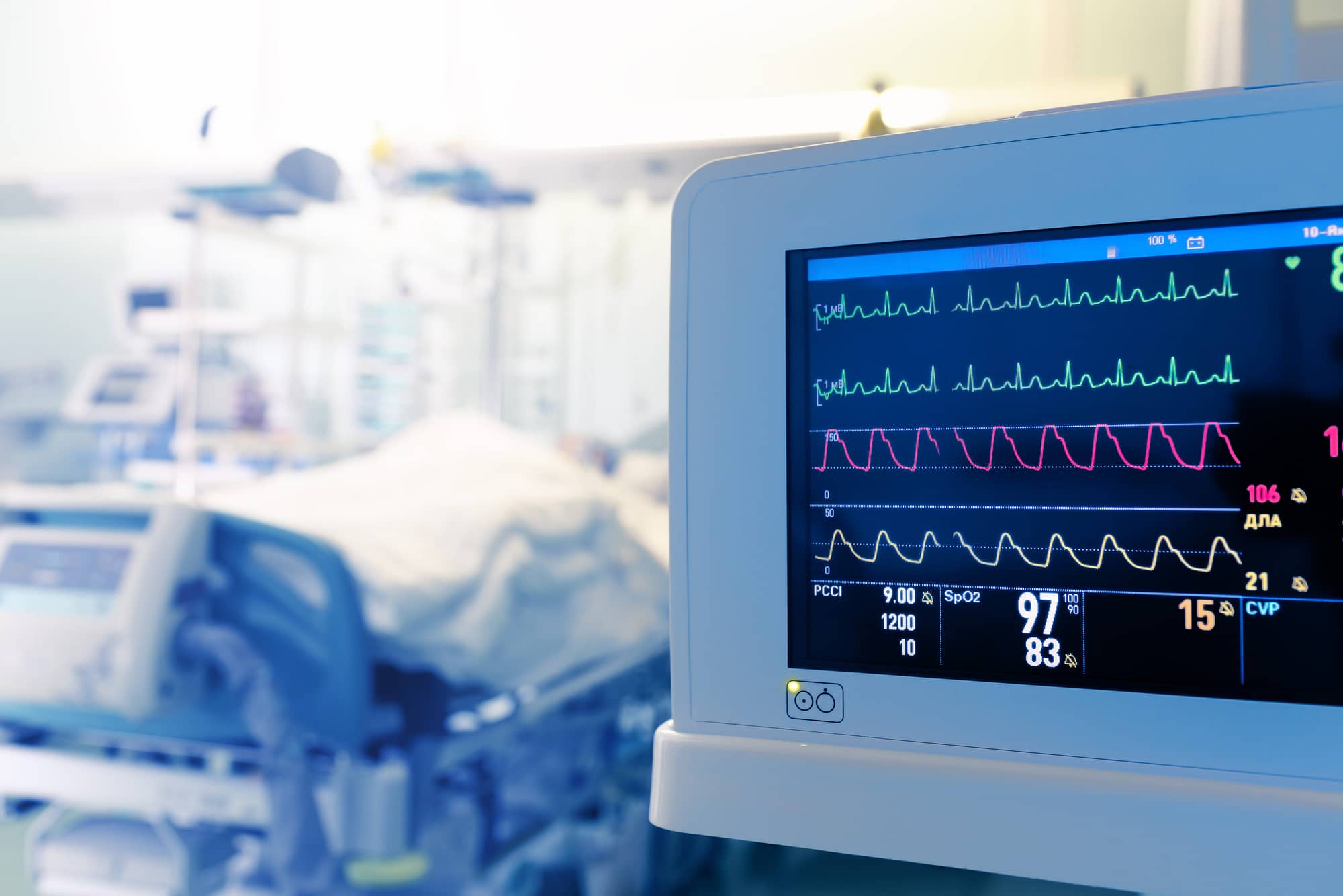 Monitoring of patient’s heart in intensive care unit