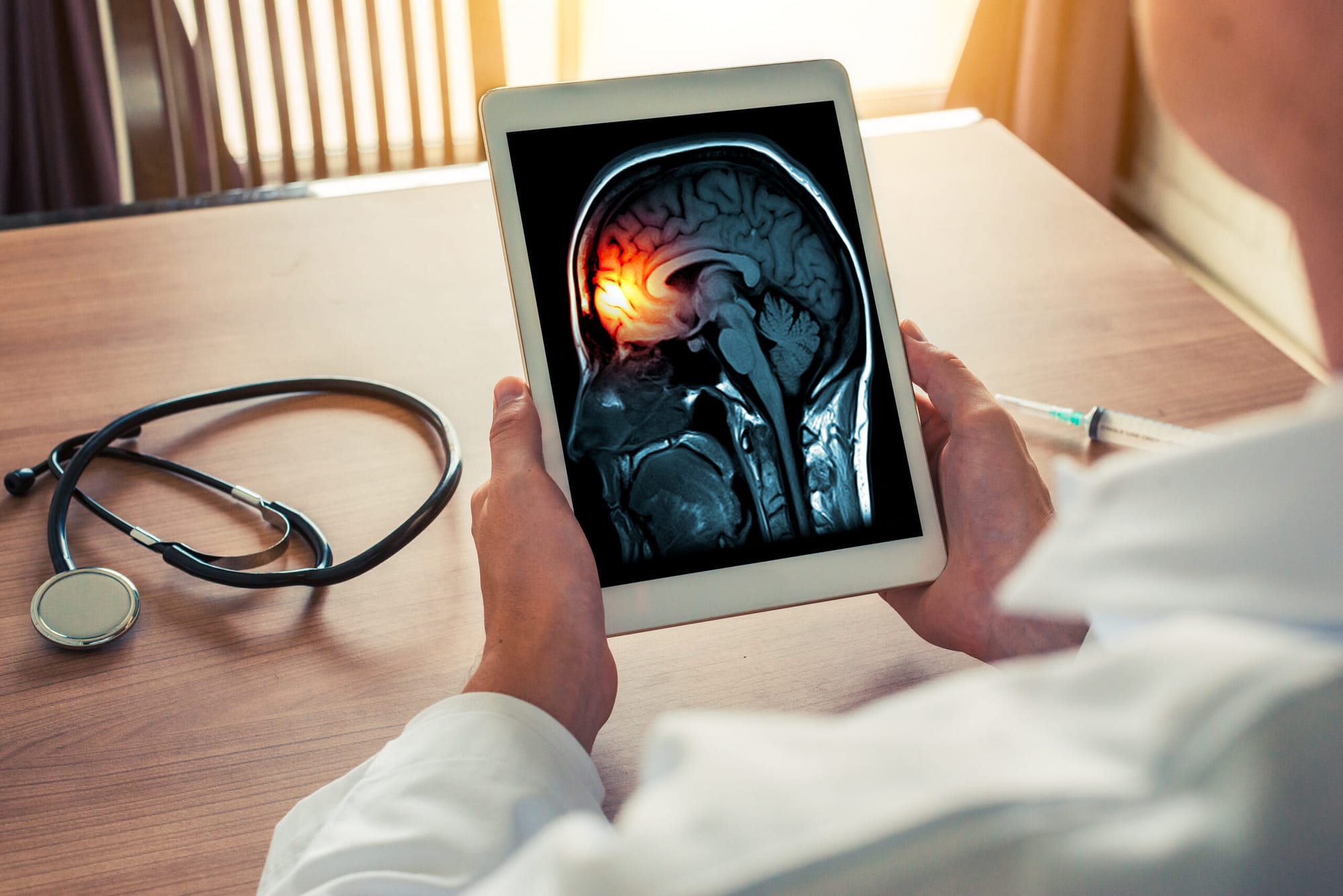 5812323 Doctor holding a digital tablet with x-ray of brain and