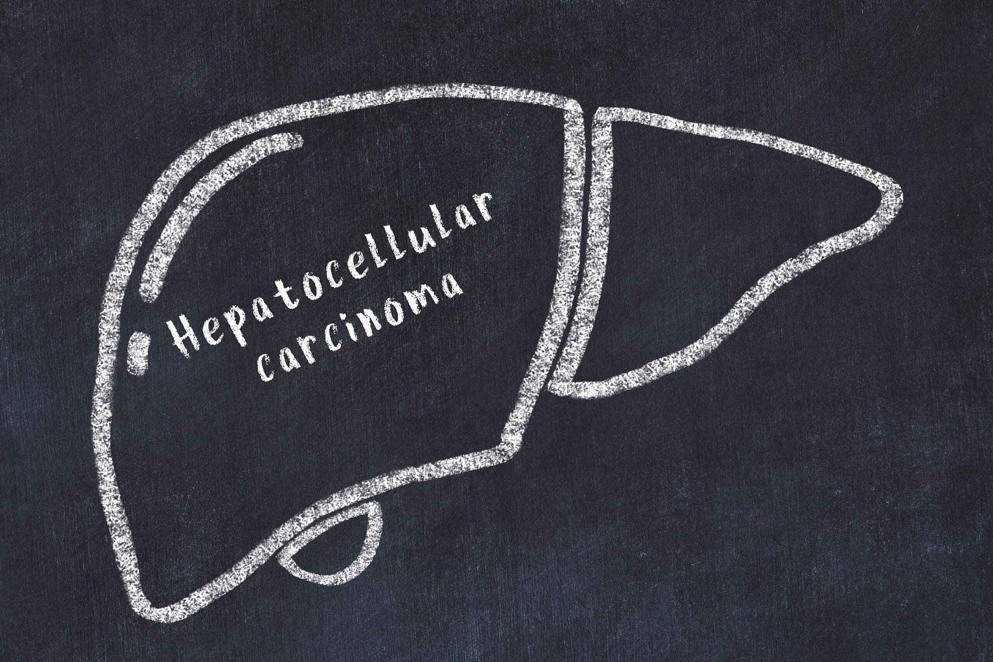 Chalk drawing of human liver with medical term. Concept of learn