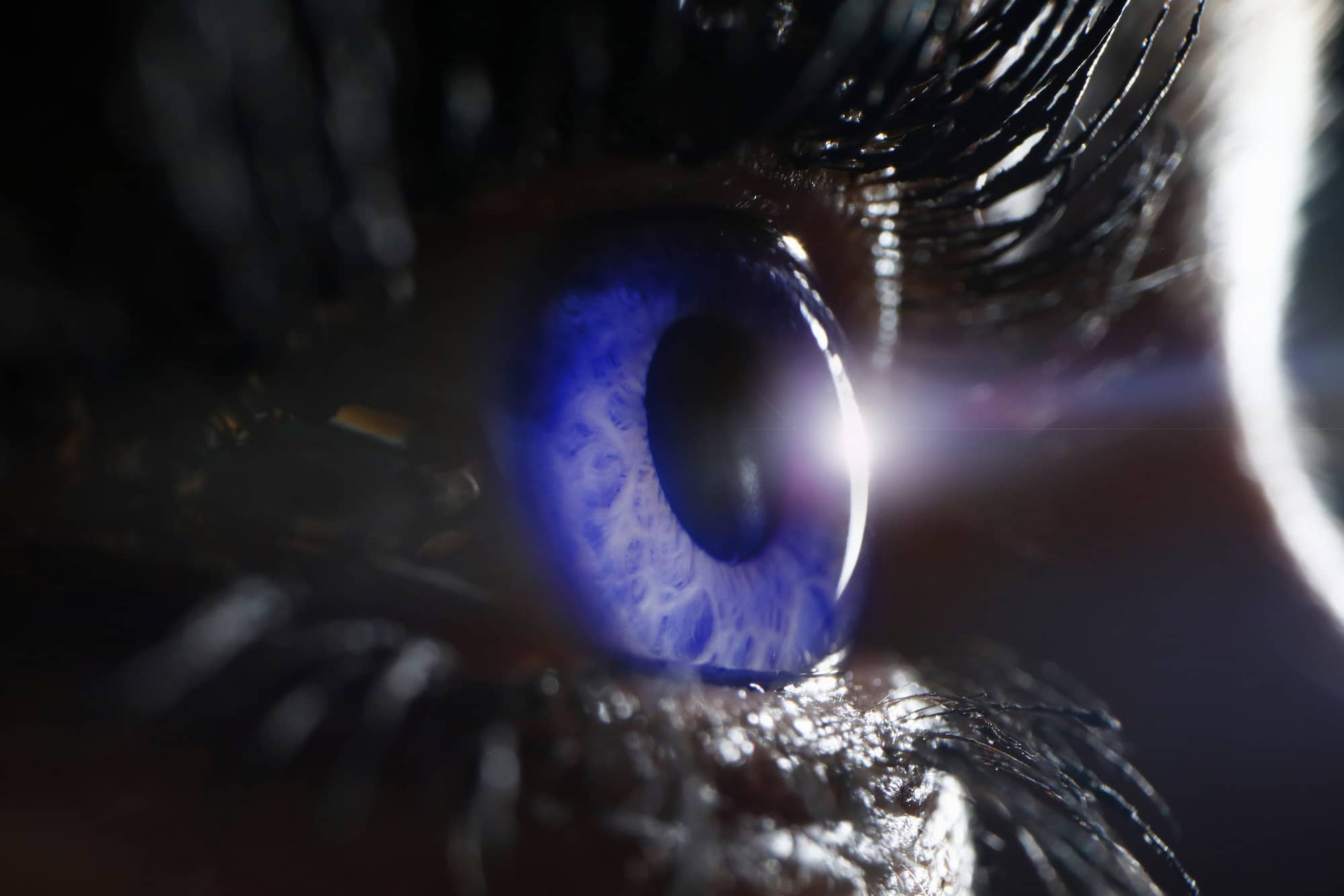 Blue female eye on surgery clinic exam closeup