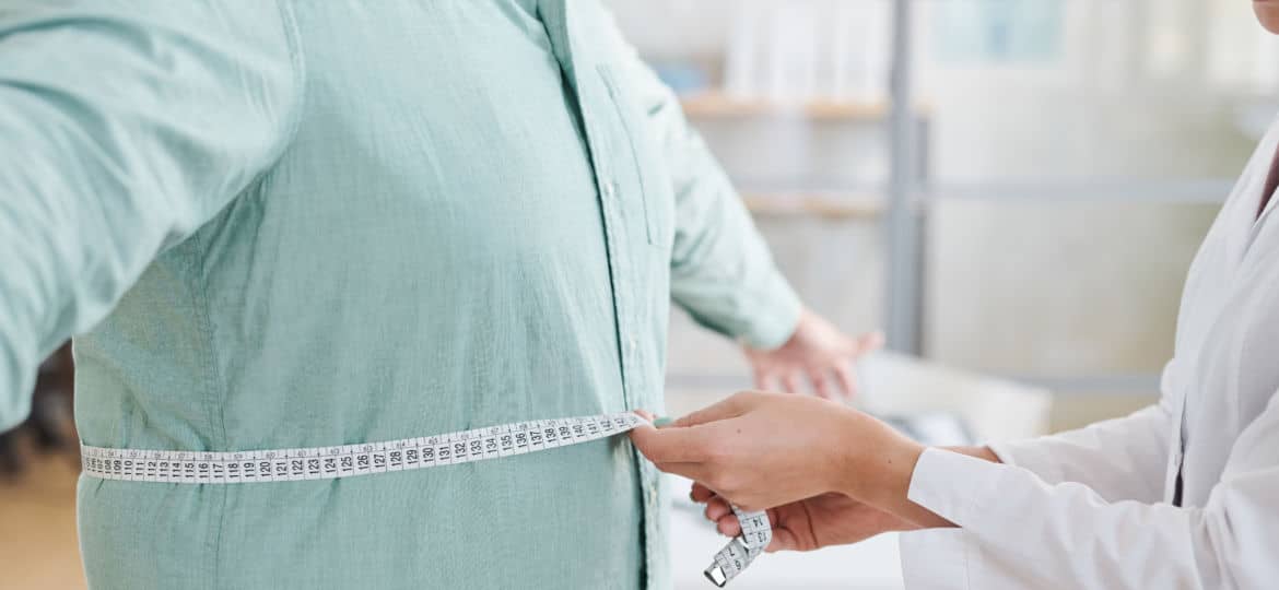 Doctor measuring obese man stomach