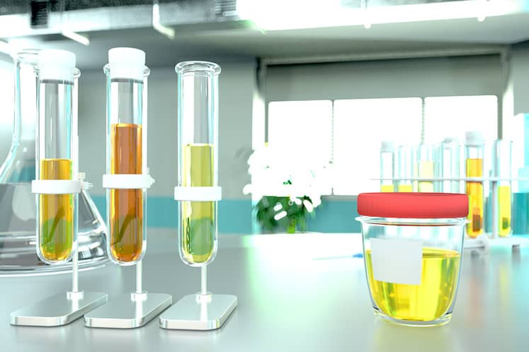 Urine sample test for covid-2019 or protein in urine proteinuria – laboratory test-tubes in modern biochemistry office, medical 3D illustration