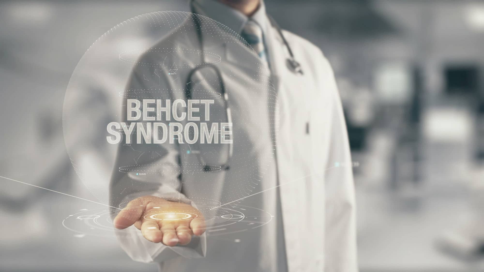 Doctor holding in hand Behcet Syndrome