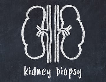 kidney biopsy