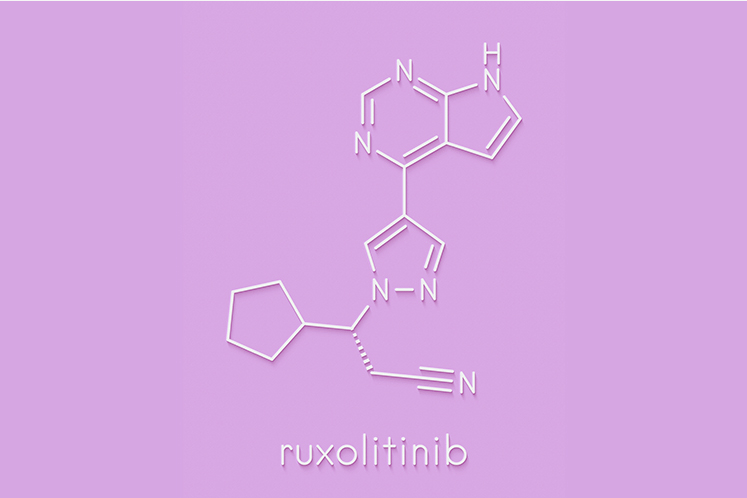 Azacytidine Added to Ruxolitinib Shows Promise in Myelofibrosis
