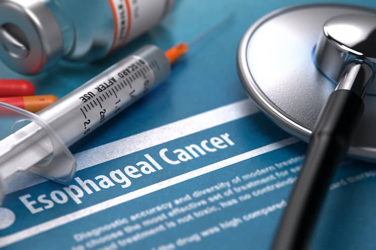 Esophageal Cancer. Medical Concept on Blue Background.