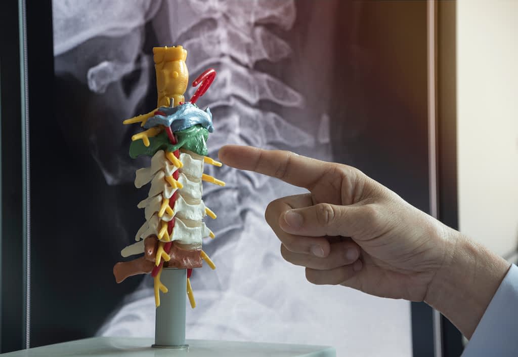 Doctor pointing to colored area on model of human spine