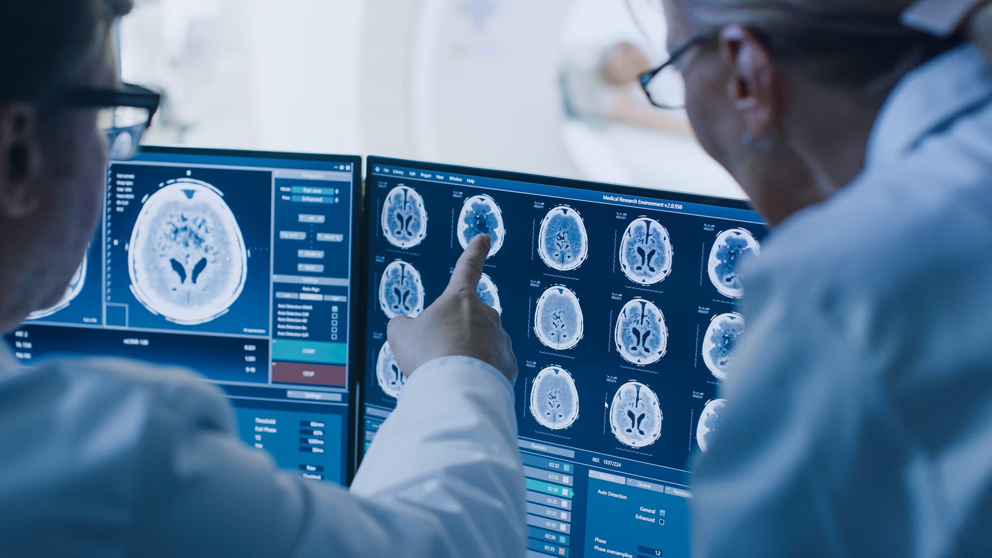 Doctors examining brain images