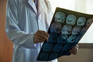 Doctor holding film of brain scans
