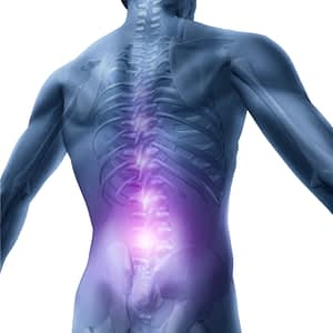 Chronic back pain is becoming an epidemic in America. This image highlights the area of back pain most individuals experience.